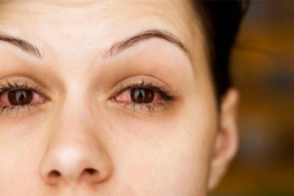 Treatment of eye pain Insomnia
