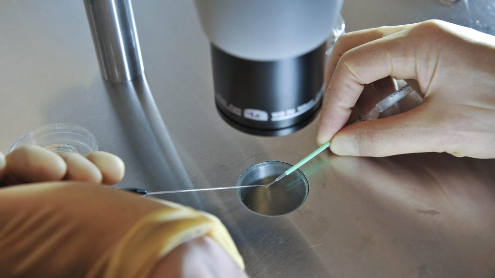 What are the stages of IVF?